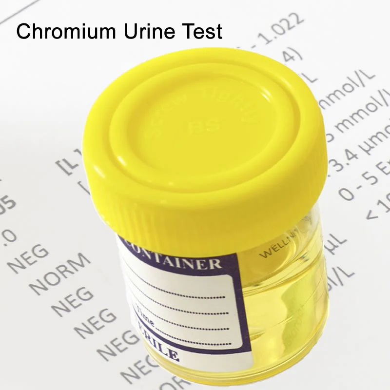 Chromium Random Urine Test